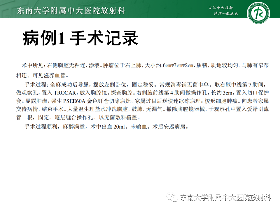 【PPT】胸部孤立性纤维瘤-7