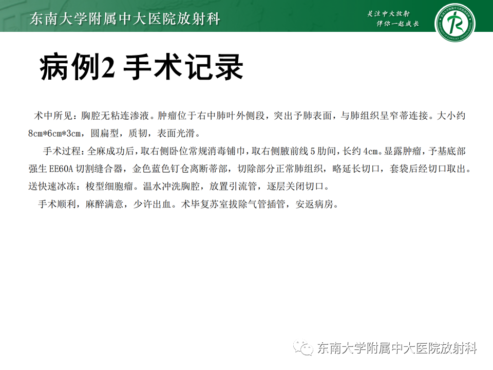 【PPT】胸部孤立性纤维瘤-11