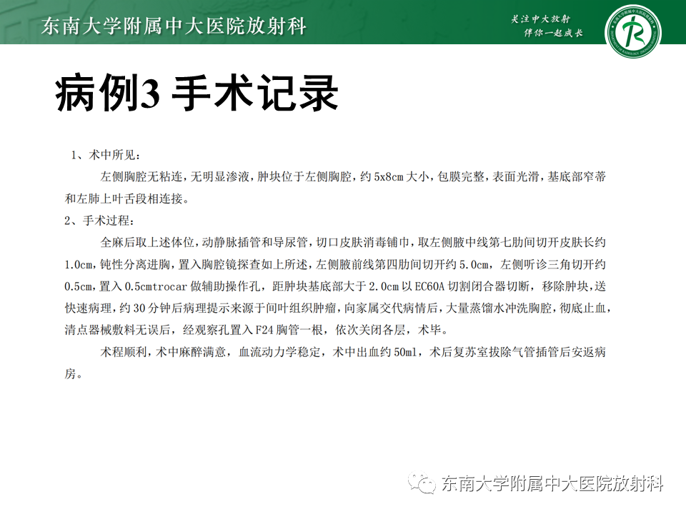 【PPT】胸部孤立性纤维瘤-15