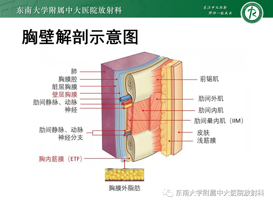 【PPT】胸部孤立性纤维瘤-20