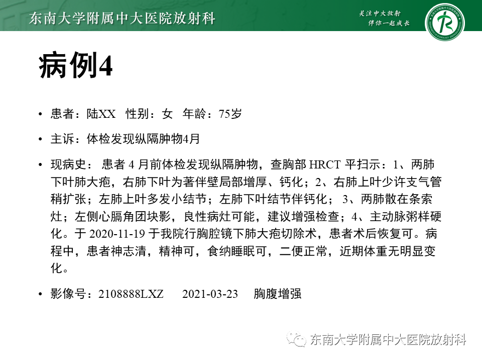 【PPT】胸部孤立性纤维瘤-28