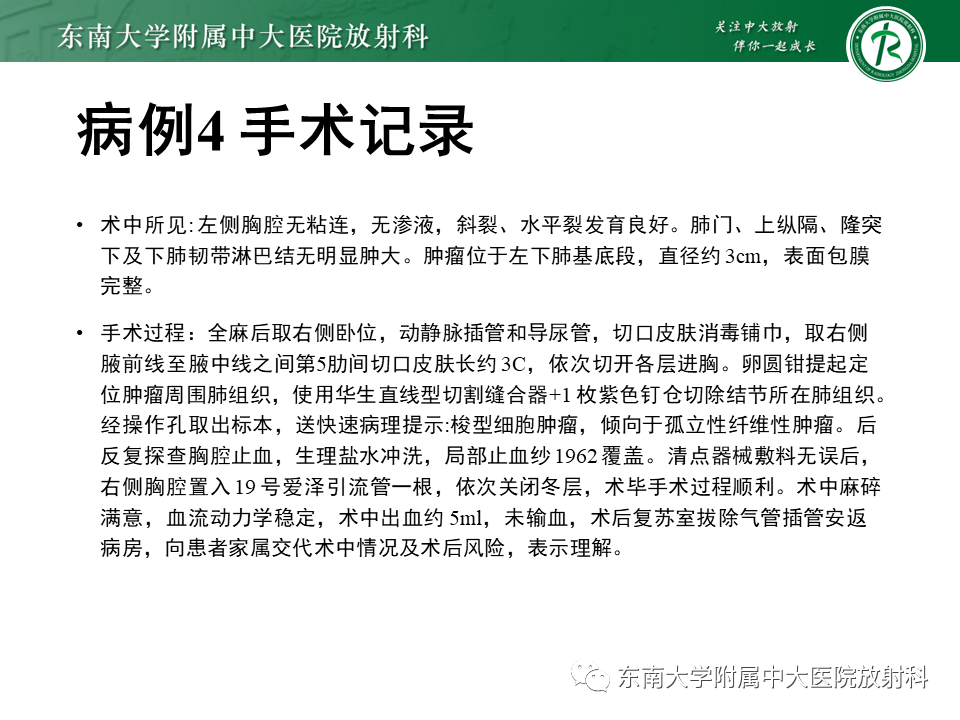 【PPT】胸部孤立性纤维瘤-30