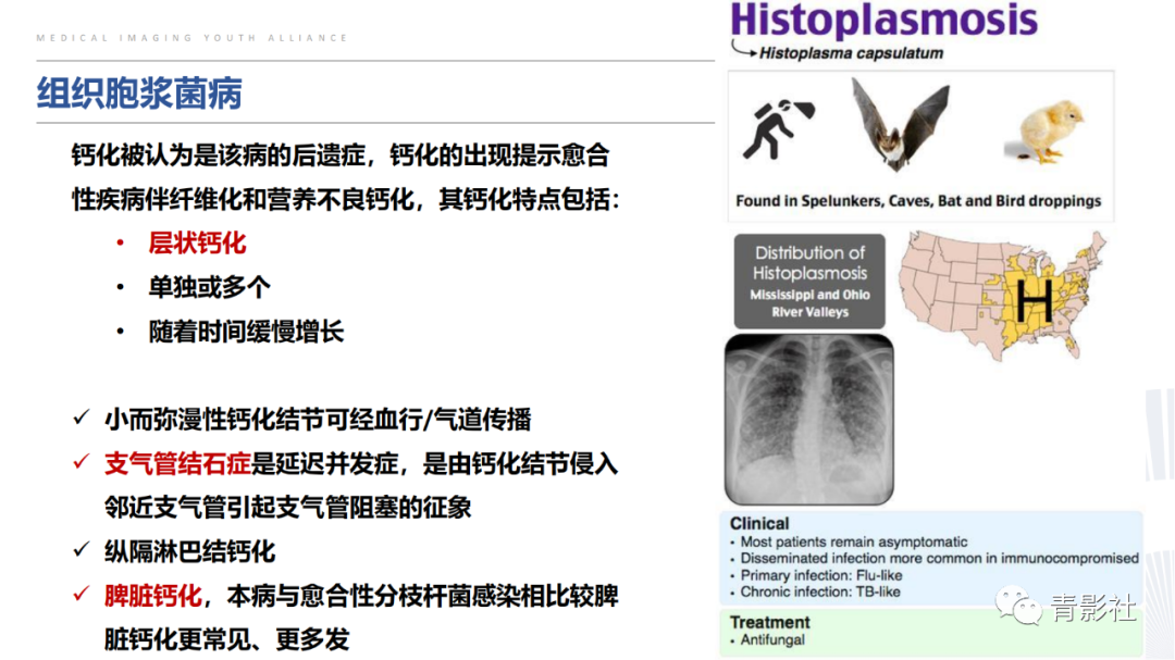 【PPT】胸部钙化临床意义和疾病谱-12