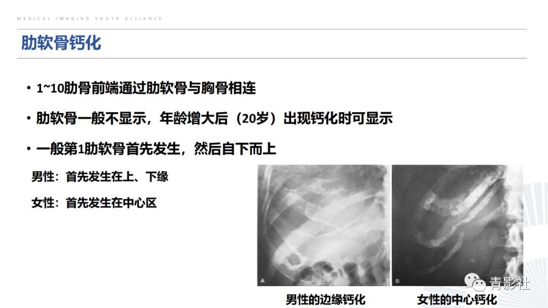 【PPT】胸部钙化临床意义和疾病谱-31