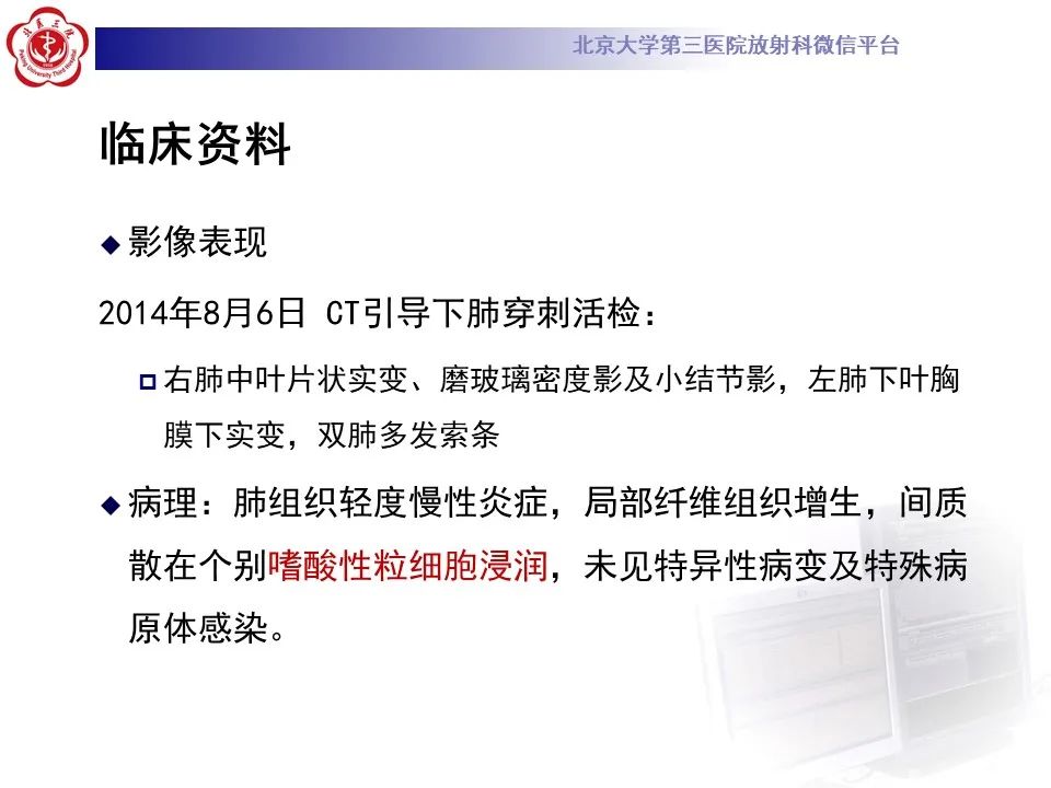 【PPT】嗜酸性肉芽肿性多血管炎-9