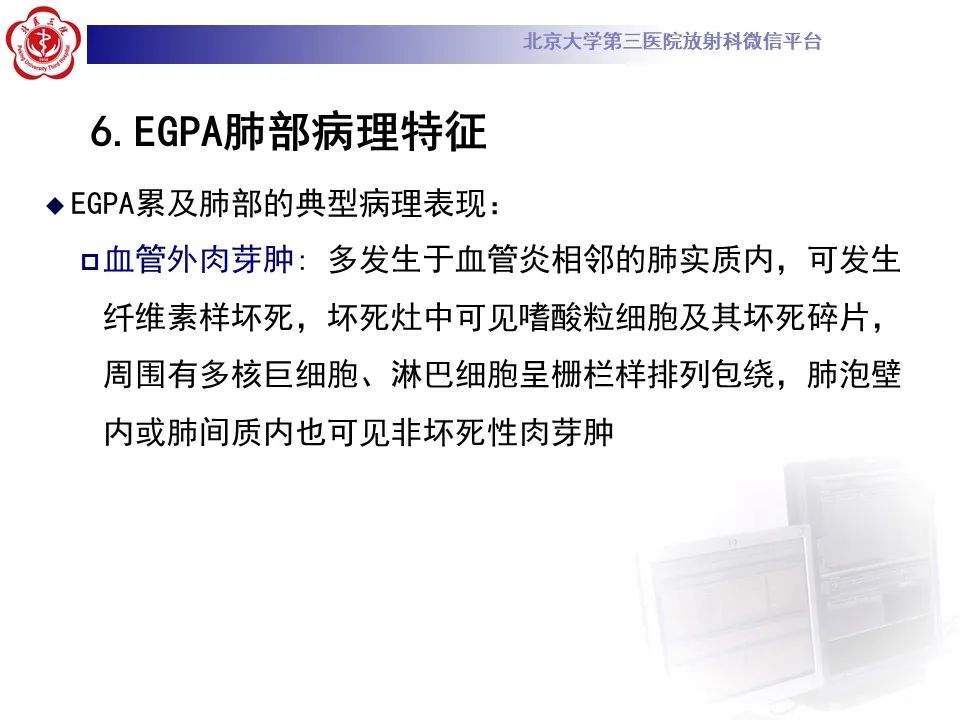 【PPT】嗜酸性肉芽肿性多血管炎-21