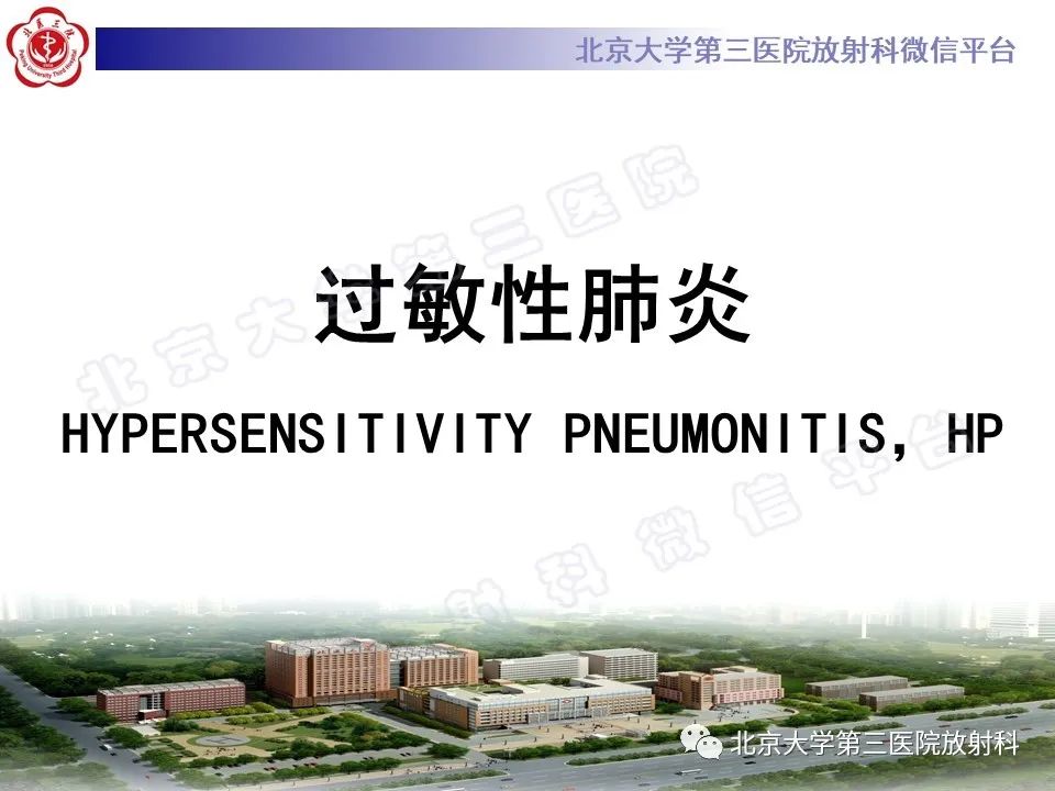 【PPT】过敏性肺炎-11
