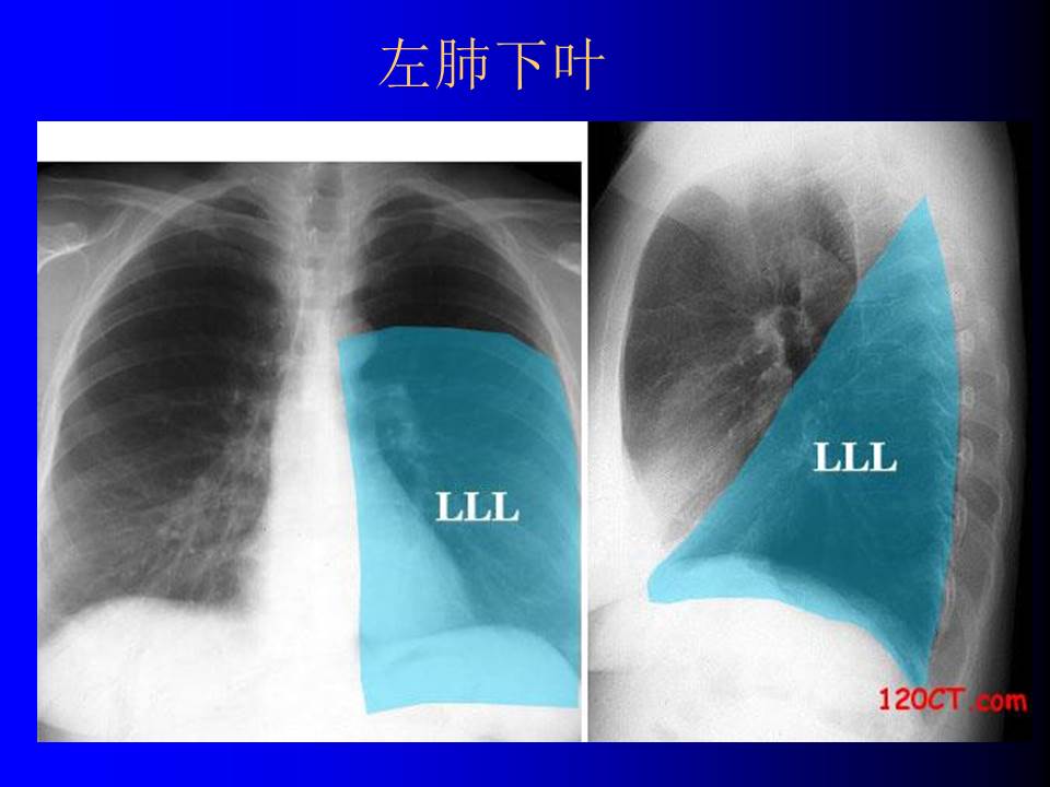 幻灯片13