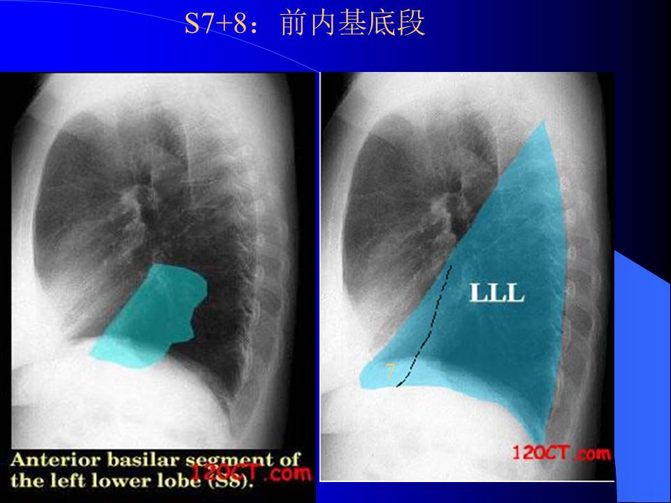 幻灯片19