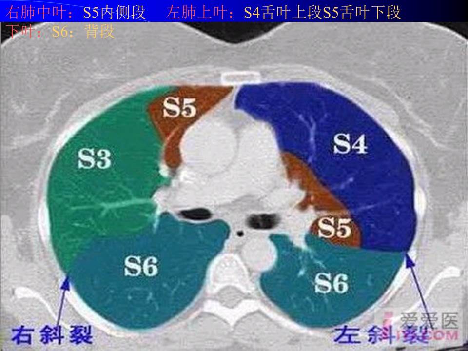幻灯片44