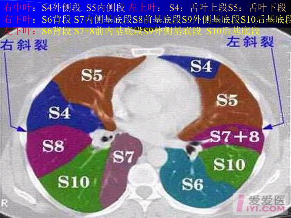 幻灯片45