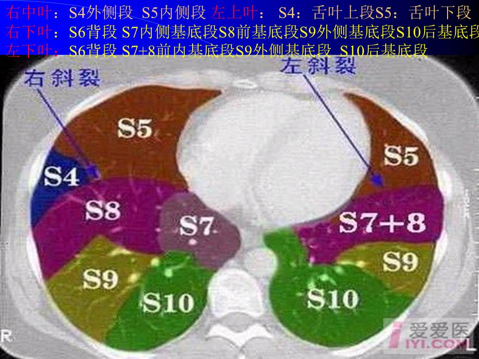 幻灯片46