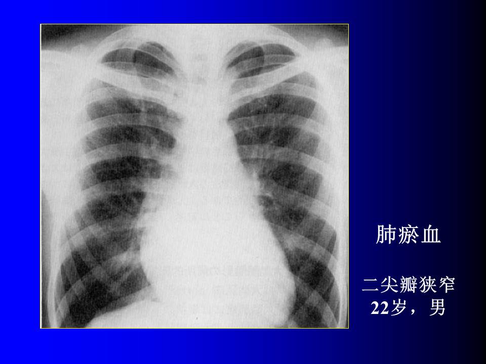 幻灯片68