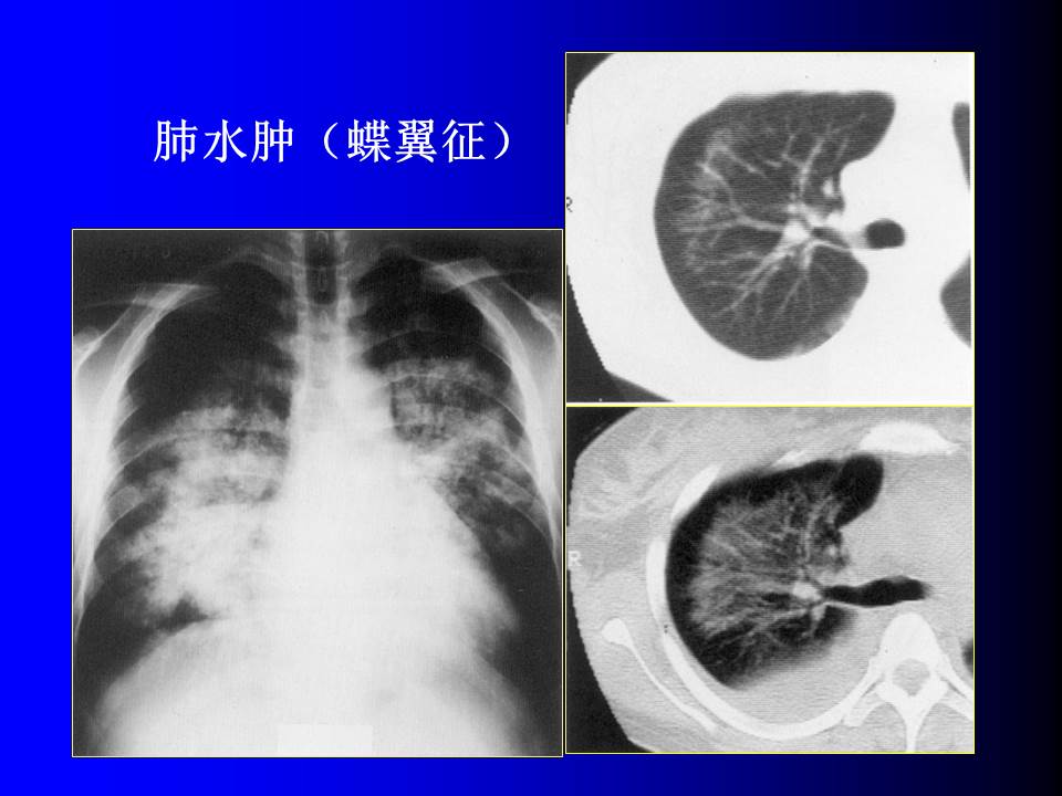 幻灯片73