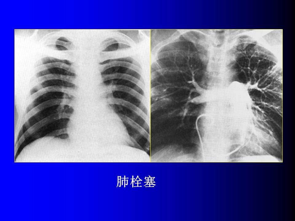 幻灯片77
