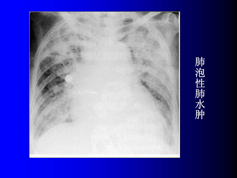 幻灯片74