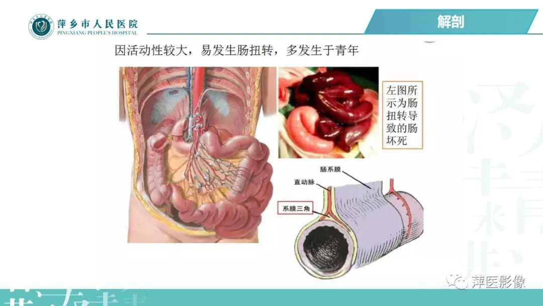 【PPT】腹腔游离气体-15