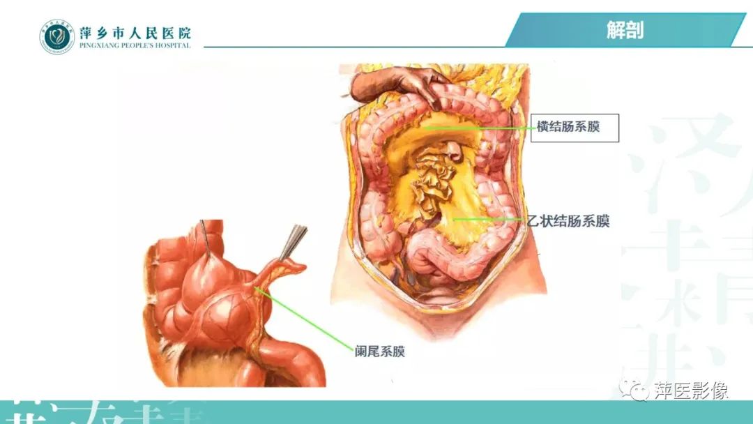 【PPT】腹腔游离气体-16