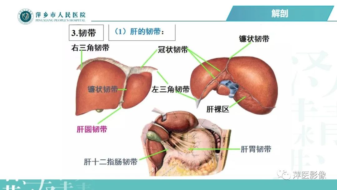 【PPT】腹腔游离气体-17
