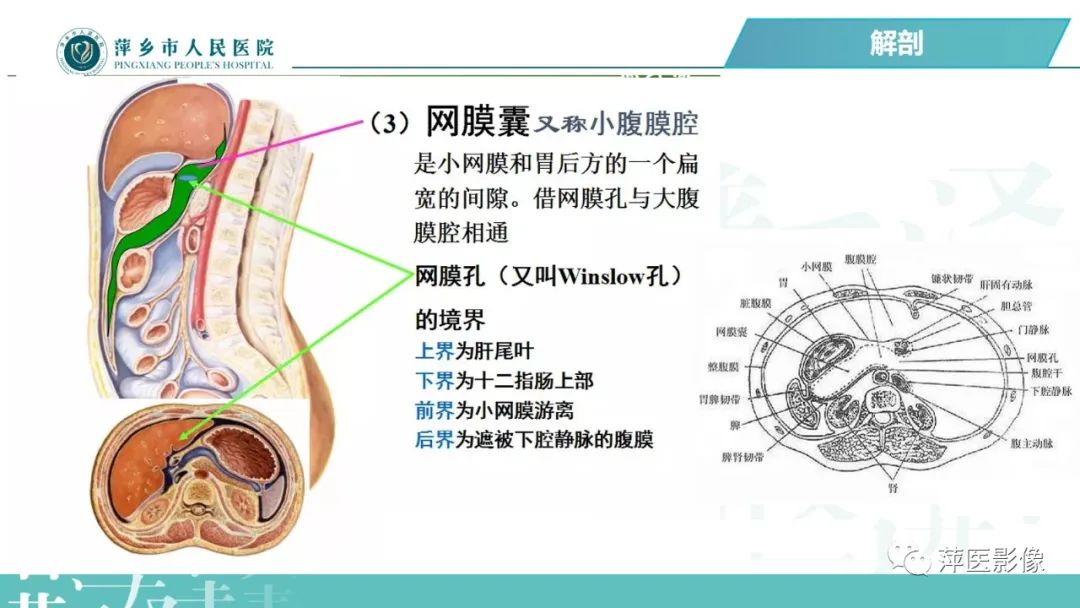 【PPT】腹腔游离气体-12