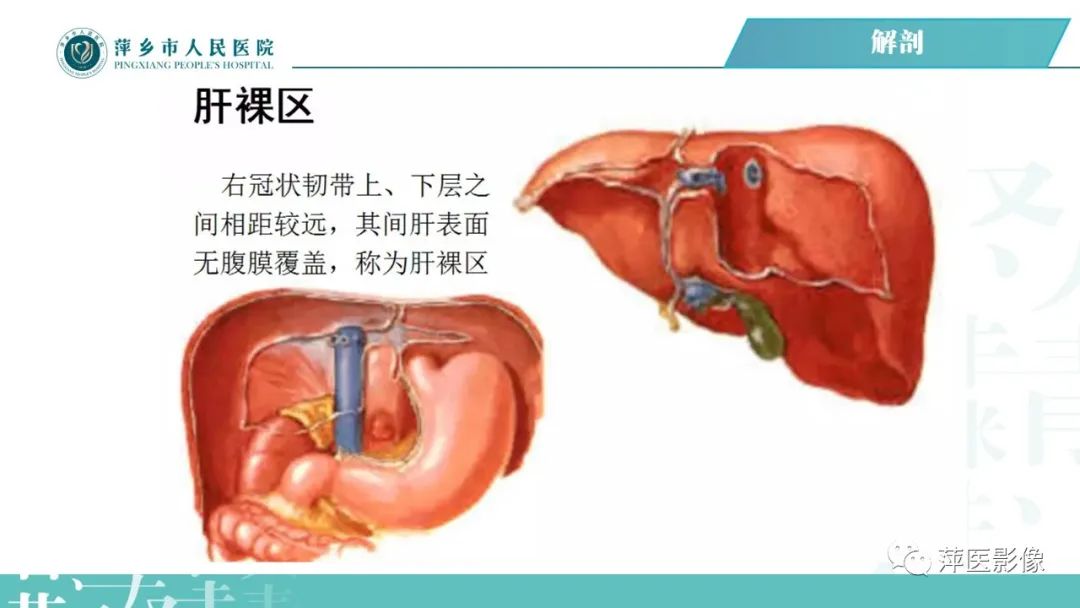 【PPT】腹腔游离气体-18