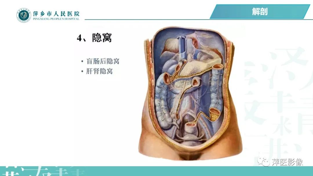 【PPT】腹腔游离气体-22