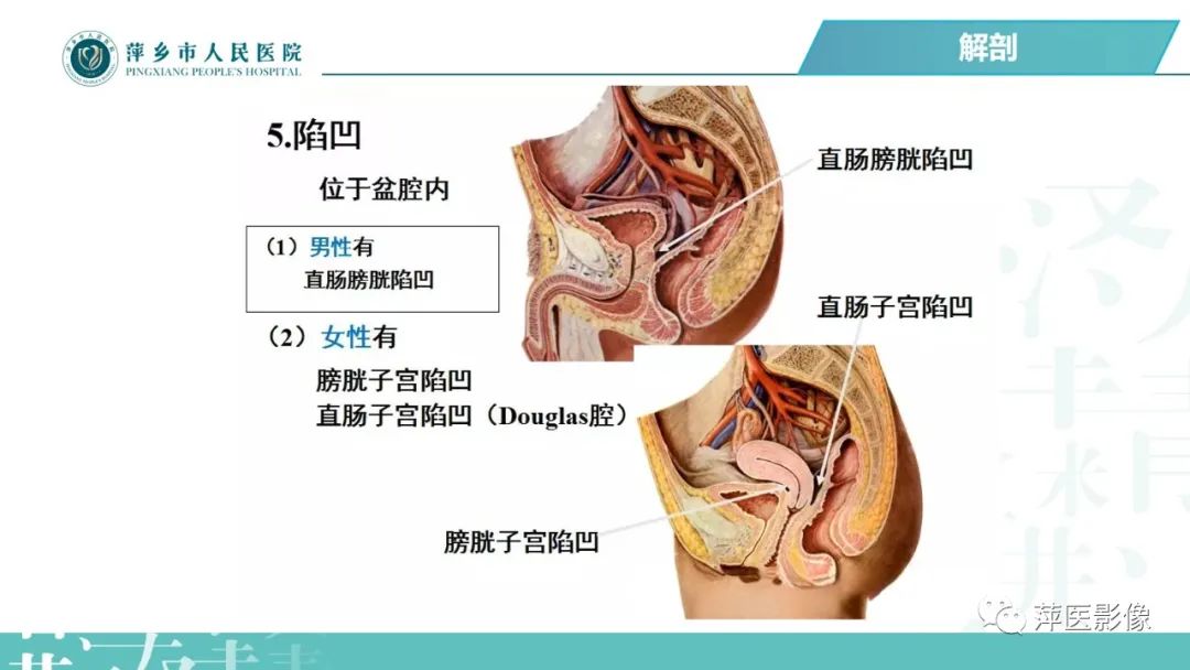 【PPT】腹腔游离气体-23