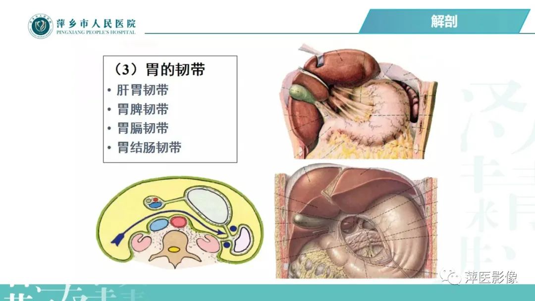 【PPT】腹腔游离气体-21