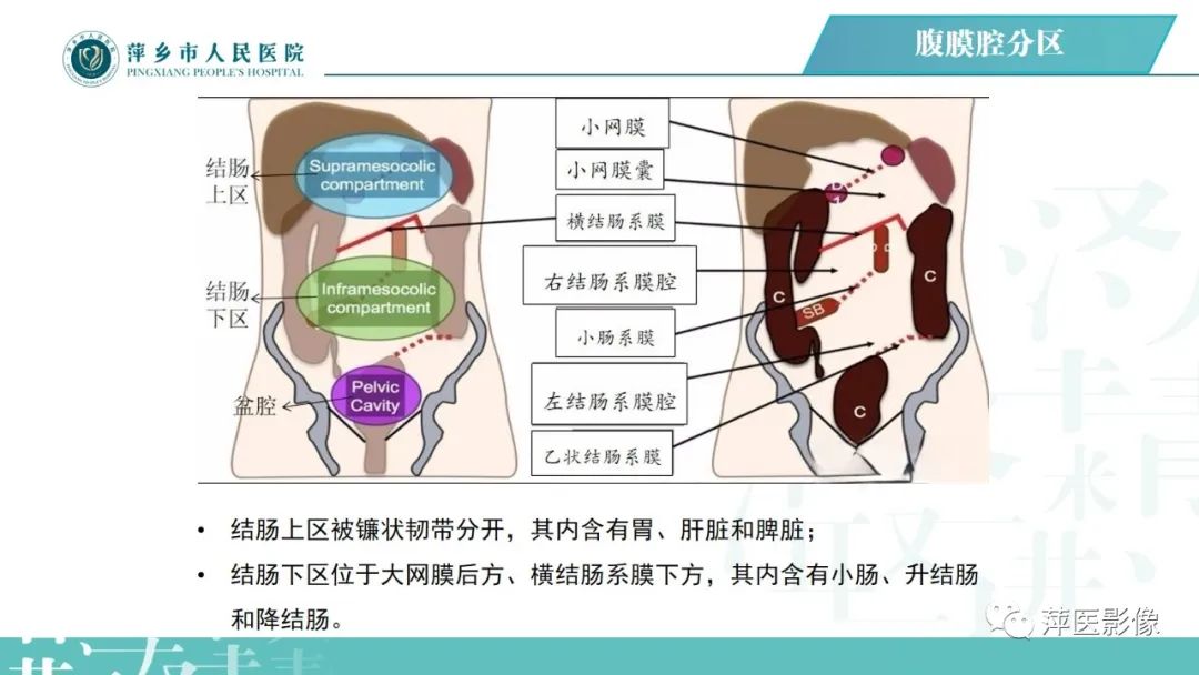 【PPT】腹腔游离气体-25