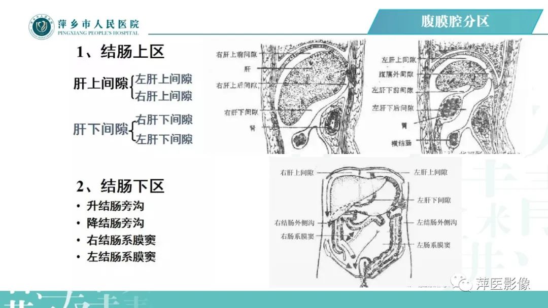 【PPT】腹腔游离气体-26