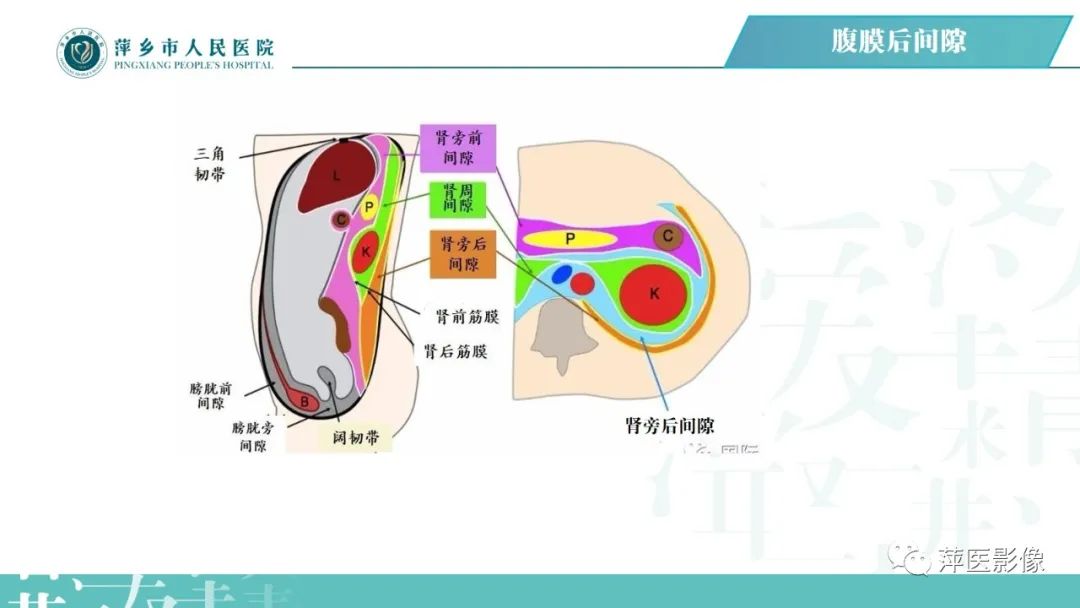 【PPT】腹腔游离气体-54