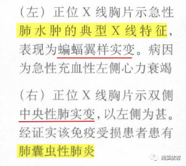 肺部之“蝙蝠翼征”-10