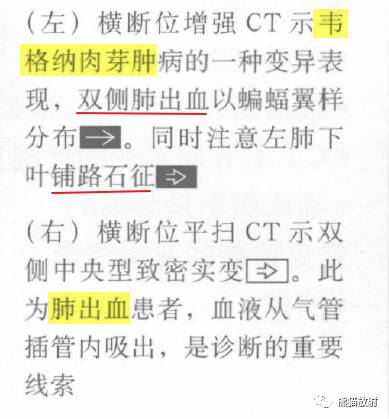 肺部之“蝙蝠翼征”-14