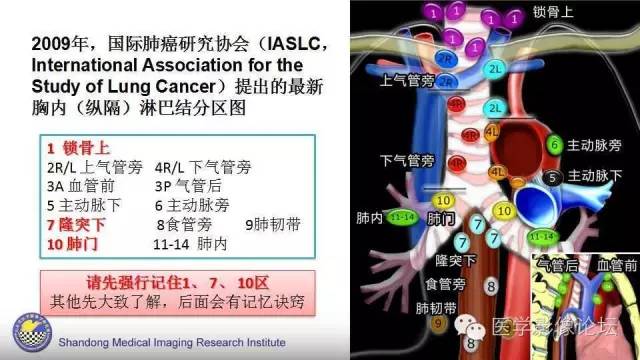 【PPT】胸内（纵隔）淋巴结分区速记-9