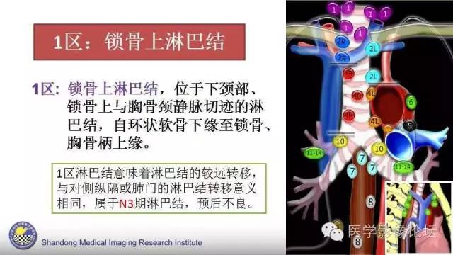 【PPT】胸内（纵隔）淋巴结分区速记-10