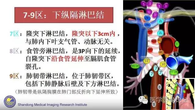 【PPT】胸内（纵隔）淋巴结分区速记-13