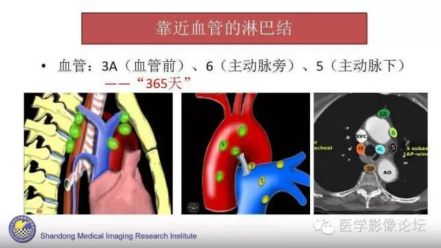 【PPT】胸内（纵隔）淋巴结分区速记-17