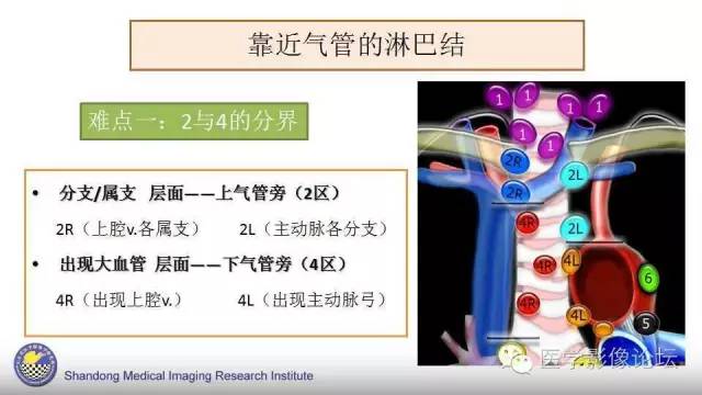 【PPT】胸内（纵隔）淋巴结分区速记-20