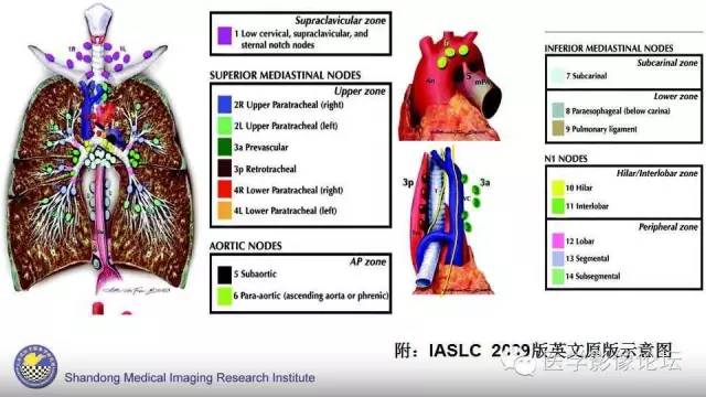 【PPT】胸内（纵隔）淋巴结分区速记-50