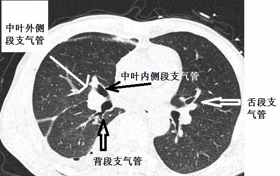 支气管CT解剖-9