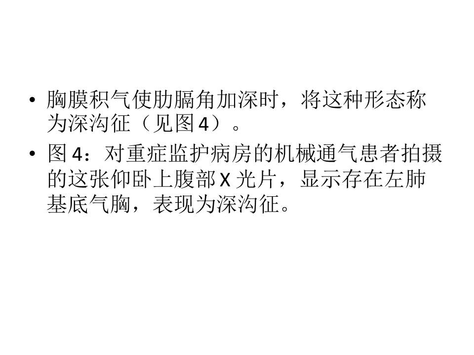 幻灯片10