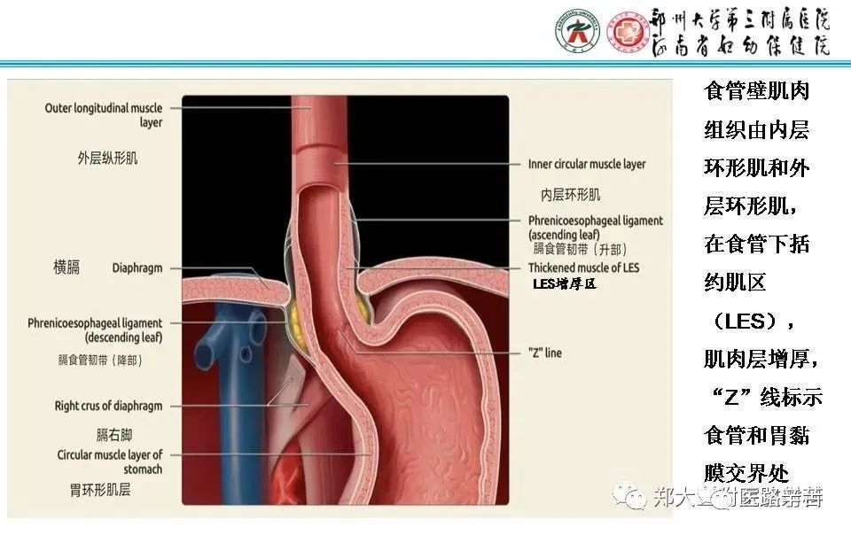 影像PPT - 食管裂孔疝CT影像表现-12