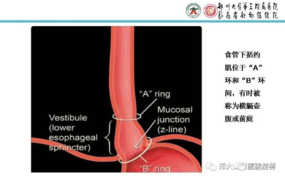 影像PPT - 食管裂孔疝CT影像表现-13