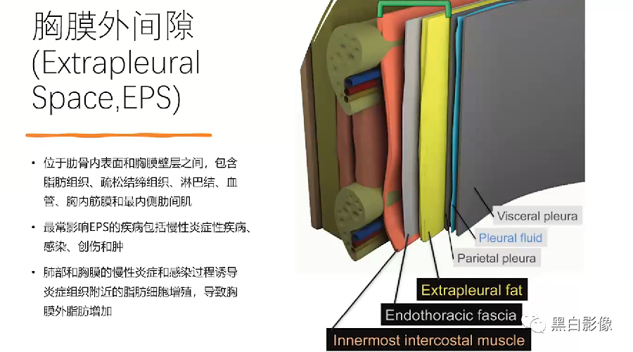 影像PPT - 【PPT】胸膜解剖及胸膜肿瘤影像诊断思路-4