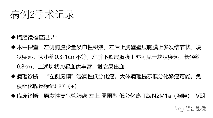 影像PPT - 【PPT】胸膜解剖及胸膜肿瘤影像诊断思路-27