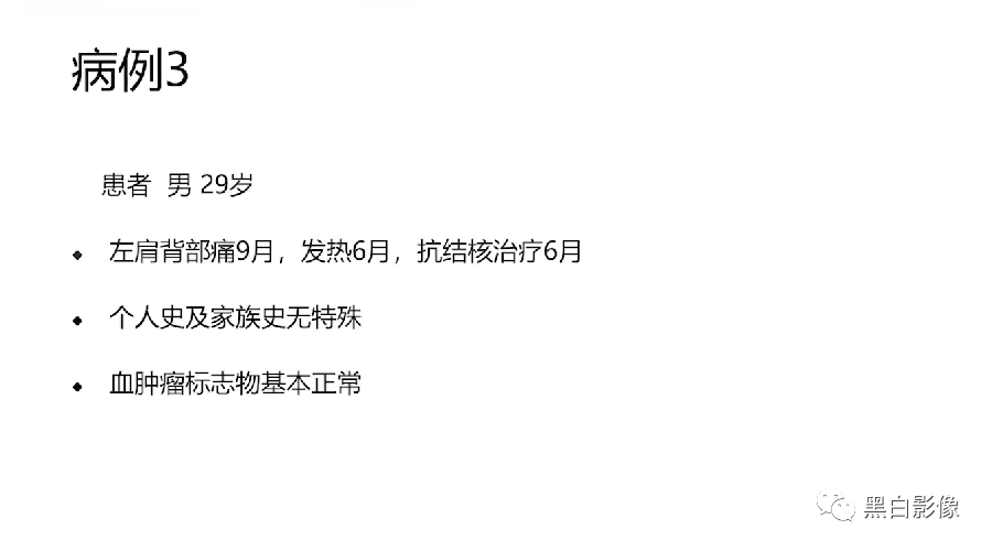 影像PPT - 【PPT】胸膜解剖及胸膜肿瘤影像诊断思路-33