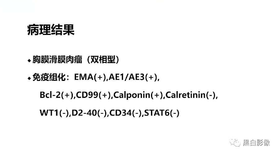 影像PPT - 【PPT】胸膜解剖及胸膜肿瘤影像诊断思路-38
