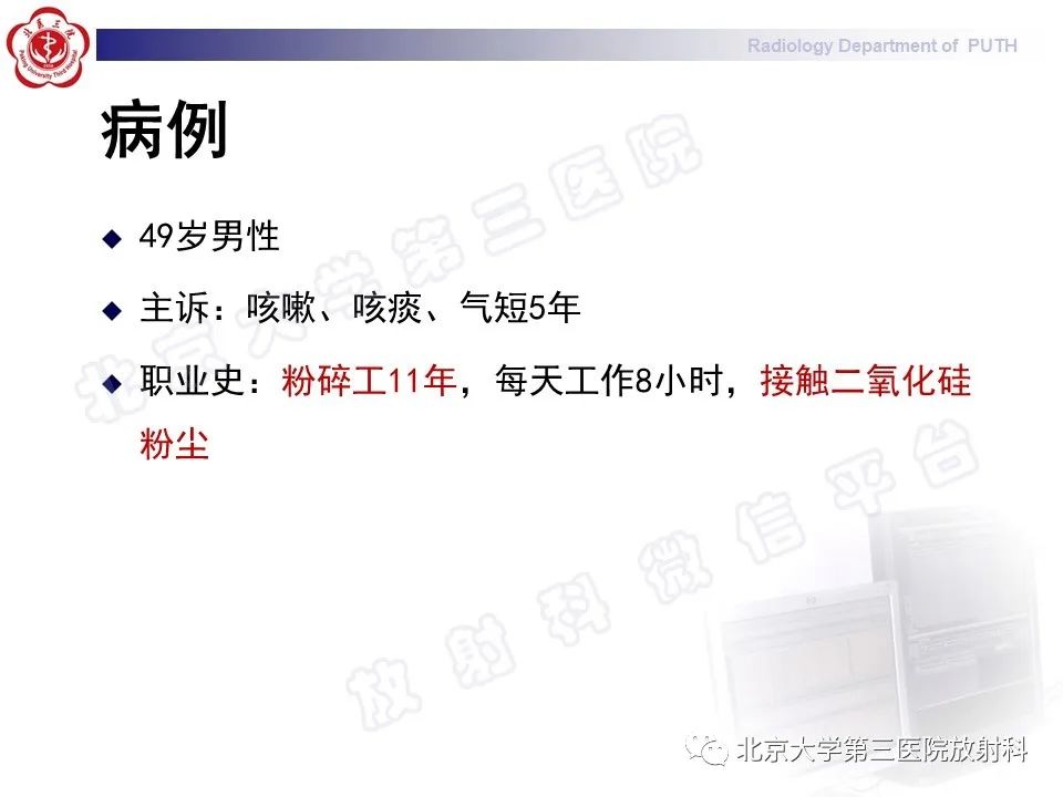 影像PPT - 【PPT】矽肺-2