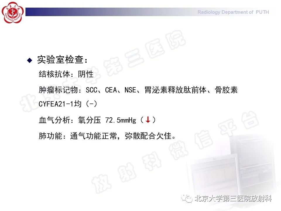 影像PPT - 【PPT】矽肺-3