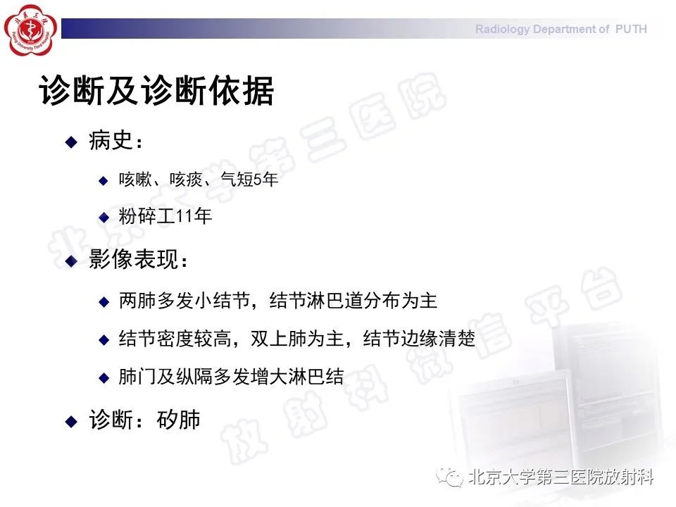 影像PPT - 【PPT】矽肺-9